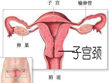  人流不当易引发四大妇科疾病