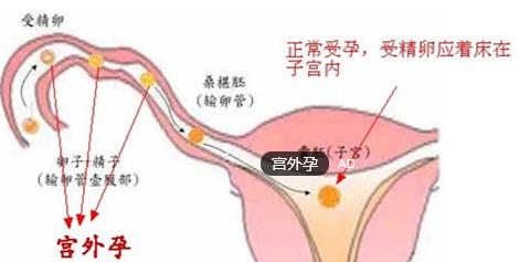 多次人流后月经量少的原因是什么呢